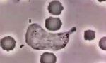 Lustiges Video : Weisse Blutzelle vs Bakterie